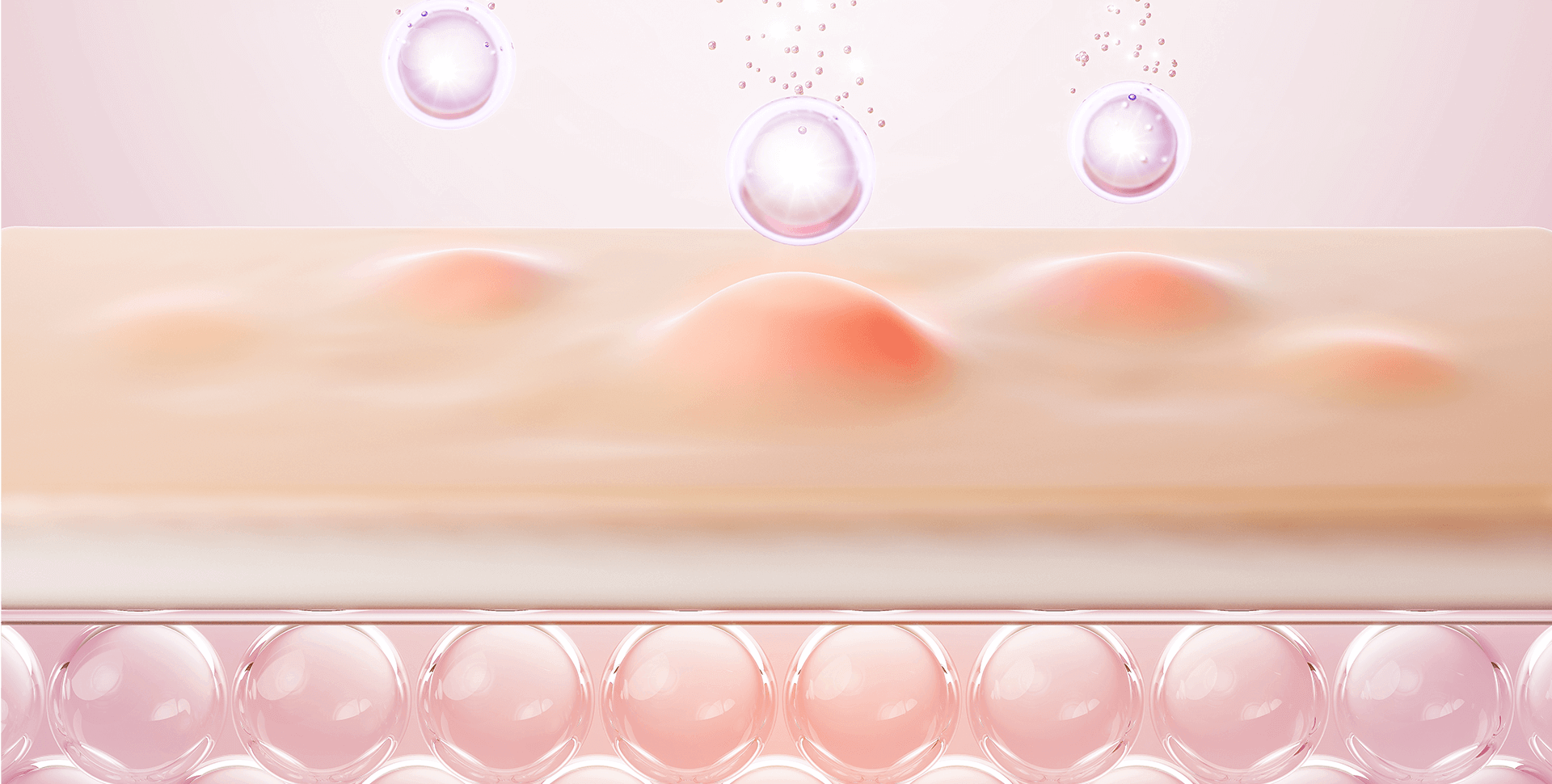 Akne (Sivilce) Nedir? | Propia