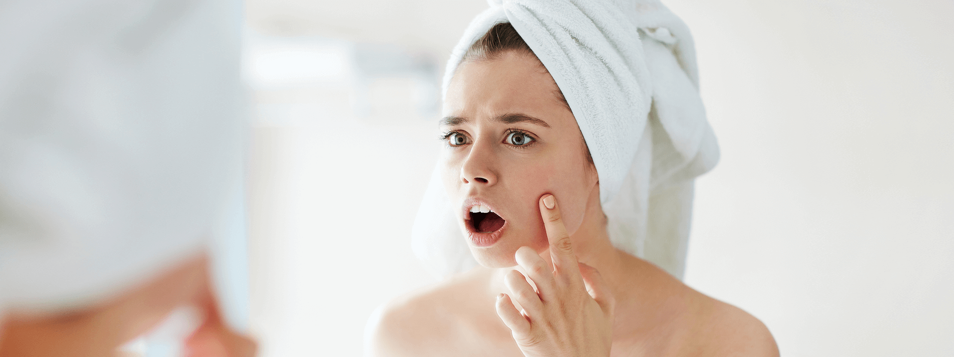 Akneye (Sivilceye) Eğilimli Ciltler için Cilt Bakım Önerileri | Propia