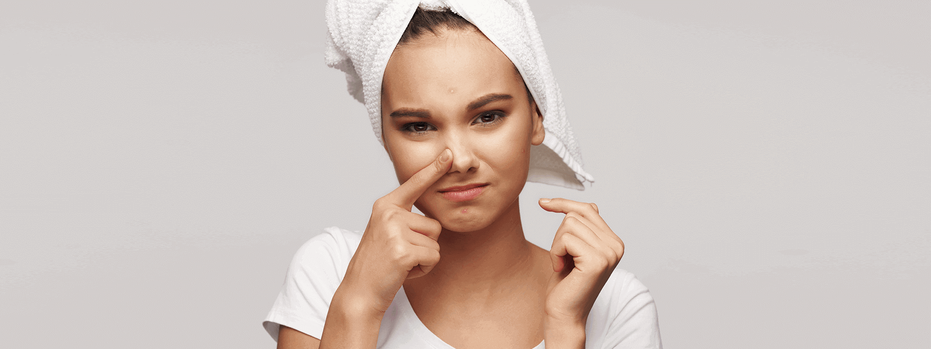 Sivilce (Akne) İzi Nasıl Oluşur? Sivilce İzleri Nasıl Geçer? | Propia