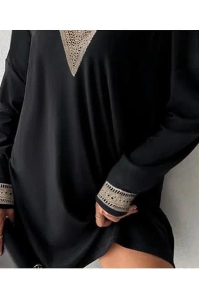 Kadın Dantel Güpür Detay V Yaka Fırsat ürün Mini Elbise