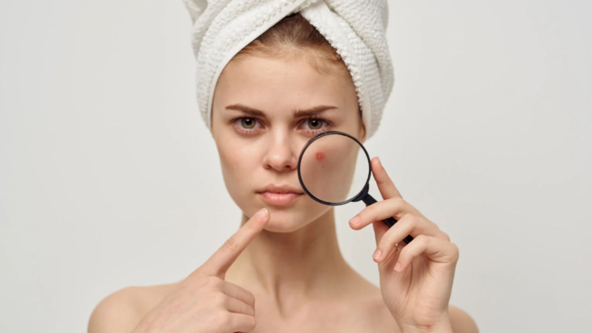 akne karşıtı serum