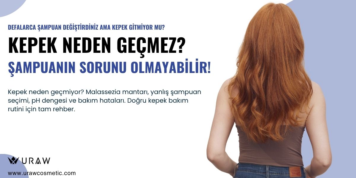 Kepek Neden Olur? Nasıl Geçer? Çözümleri