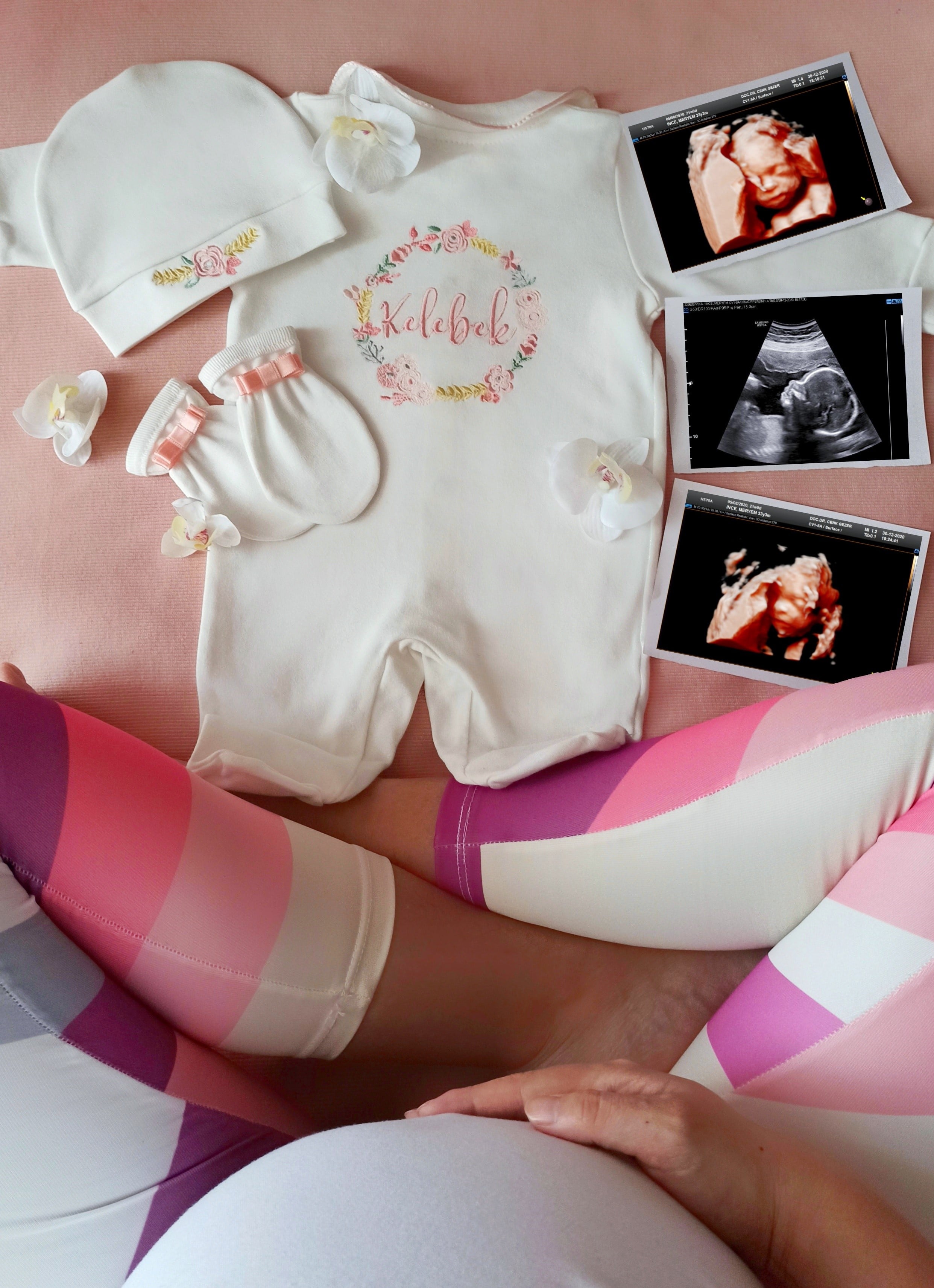 Anne Bebek