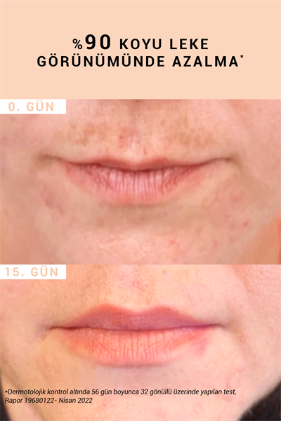 Pure Active Glabridine Leke Karşıtı Aydınlatıcı Saf Konsantre Bakım Serumu 15 ml