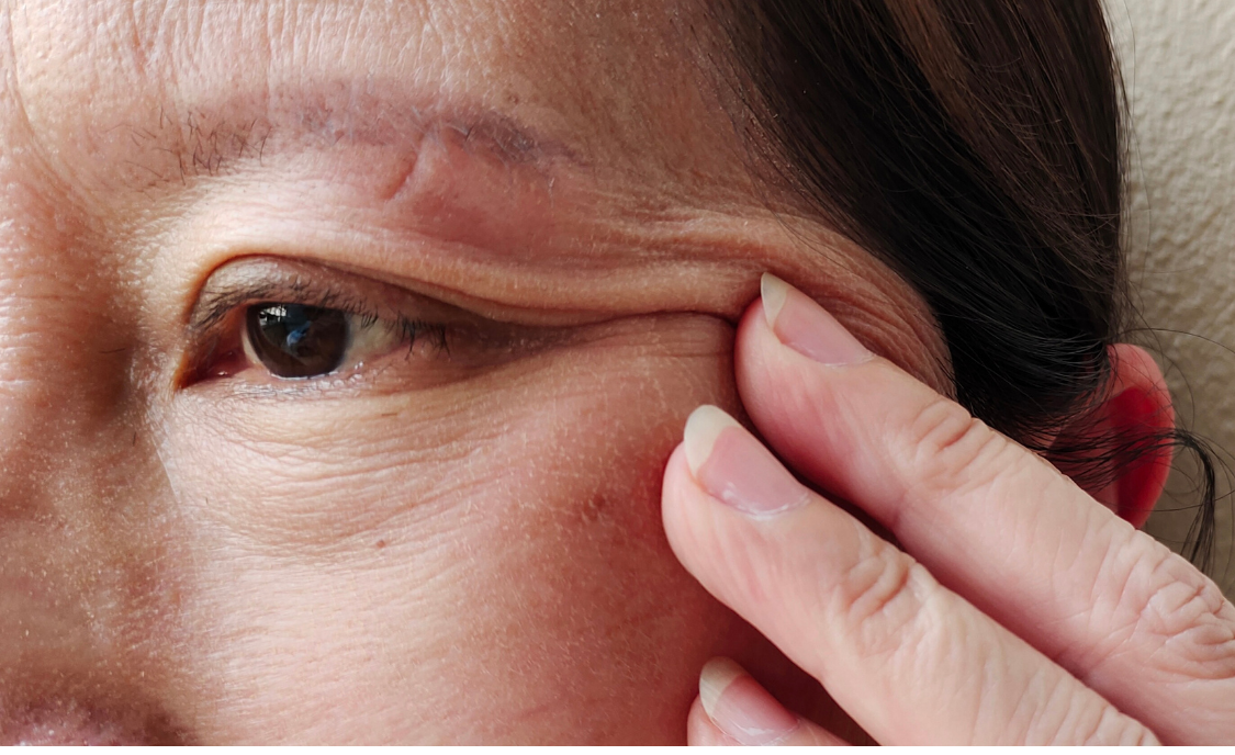 Yaşlanma Belirtilerine Karşı Tüyolar