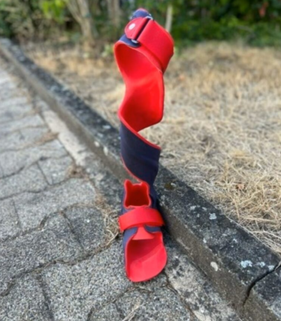 PA 11 tabanlı 3D baskı parçaları — O&P uygulamalarına uygun örnekler