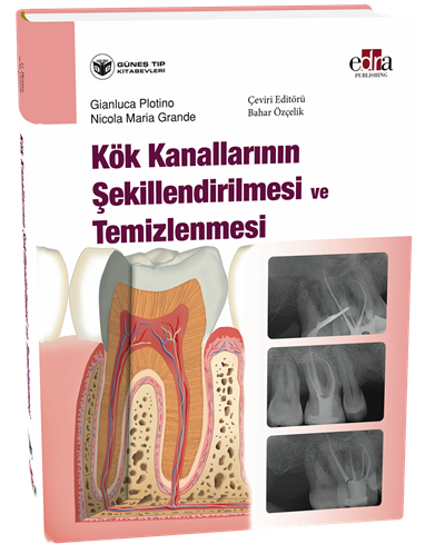 Kök Kanallarının Şekillendirilmesi ve Temizlenmesi