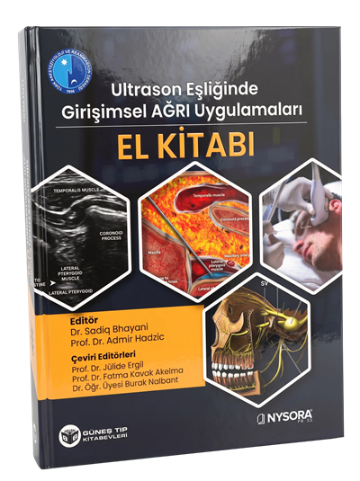 NYSORA - Ultrason Eşliğinde Girişimsel Ağrı Uygulamaları El Kitabı (Video Destekli)