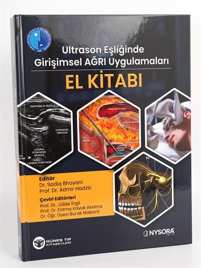 NYSORA - Ultrason Eşliğinde Girişimsel Ağrı Uygulamaları El Kitabı (Video Destekli)