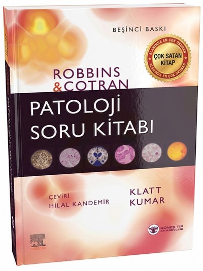 Robbins Patoloji Soru Kitabı (Kapsamlı Gözden Geçirme)