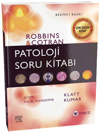 Robbins Patoloji Soru Kitabı (Kapsamlı Gözden Geçirme)