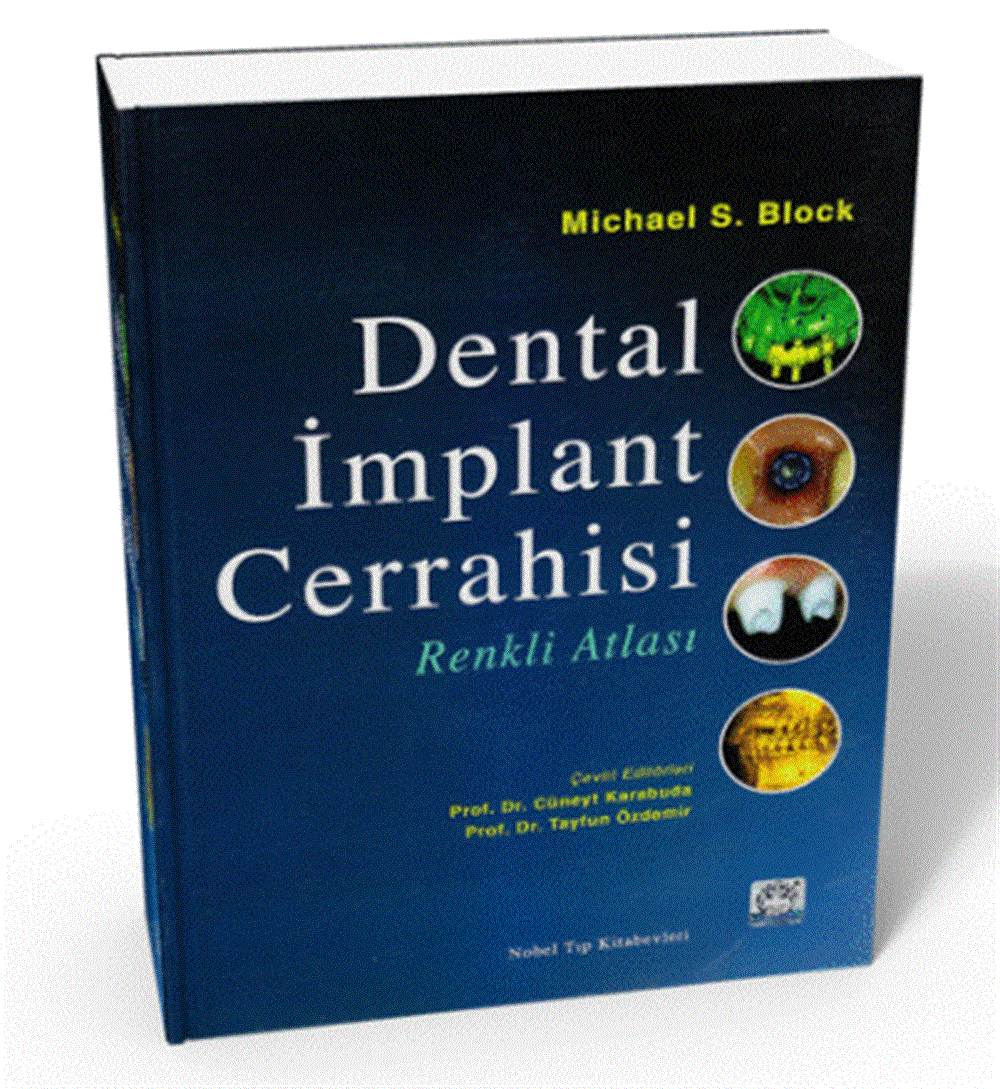 dental-implant-cerrahisi-