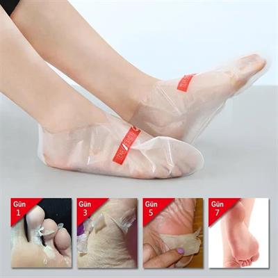 Sunup SN-26965 Ayak Peeling Maskesi (Nasır, Ölü Deri, Egzama Giderici)