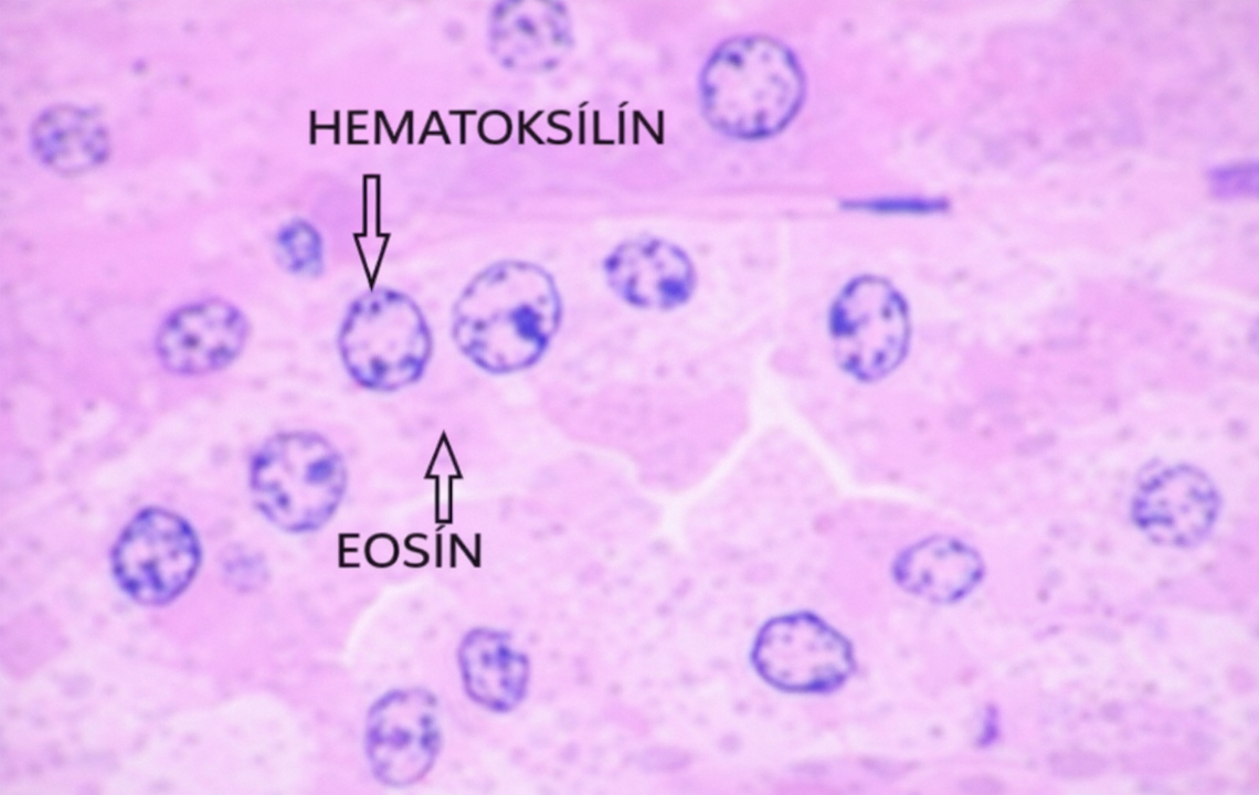 Histolojik Kesitlerde Hematoksilin ve Eozin (H&E) Boyama: Protokoller ve Yaygın Hatalar