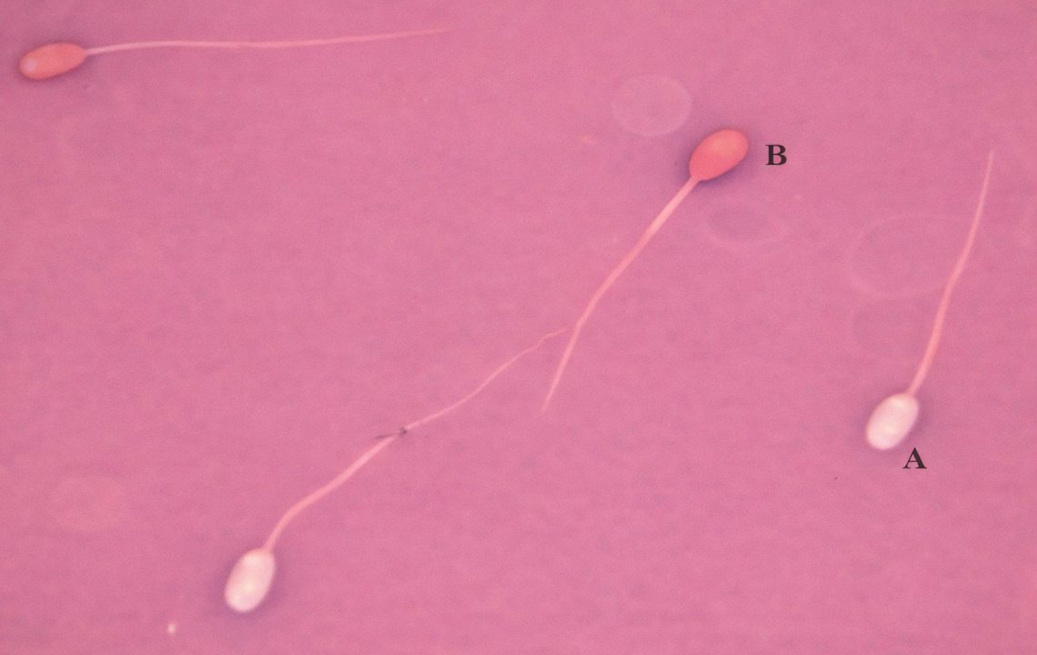 Spermatozoa Canlılığının Değerlendirilmesinde Eosin–Nigrosin Boyama Tekniğinin Önemi