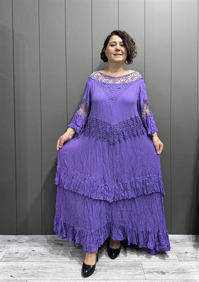 Yaka Dantelli Astalı Pamuk Elbise