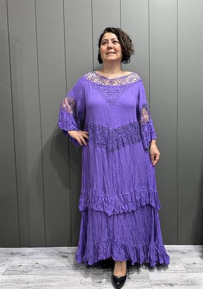 Yaka Dantelli Astalı Pamuk Elbise