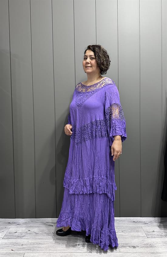 Yaka Dantelli Astalı Pamuk Elbise