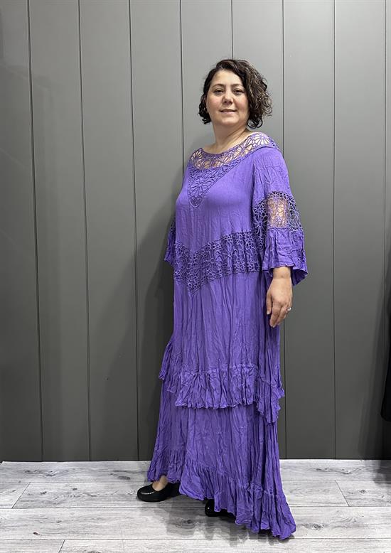 Yaka Dantelli Astalı Pamuk Elbise