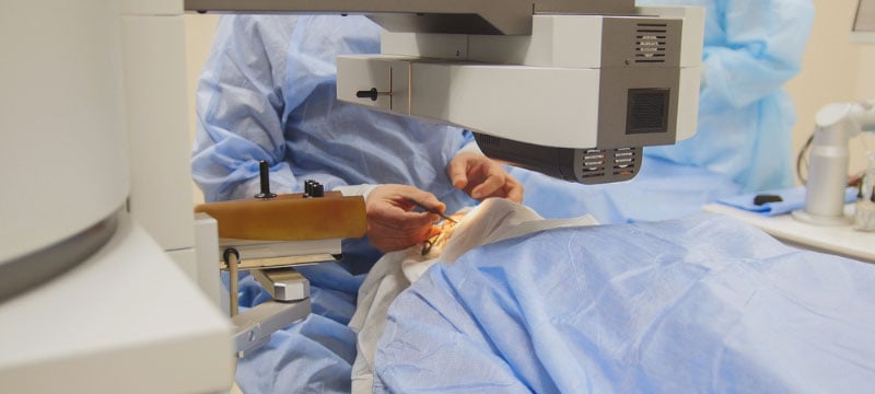 LASEK Laser