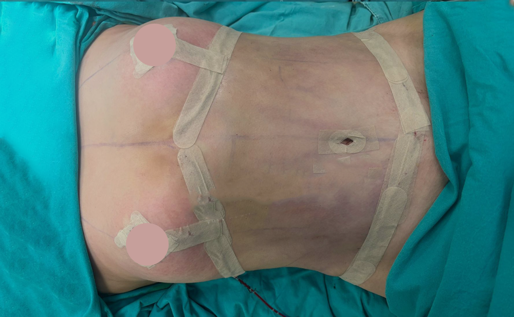 After - Patient 2