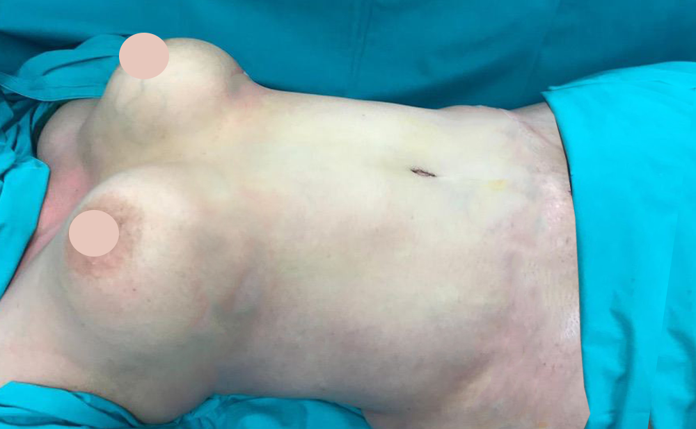 After - Patient 4