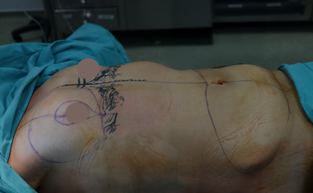 Before - Patient 1