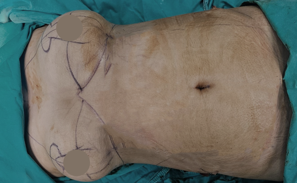 Before - Patient 2
