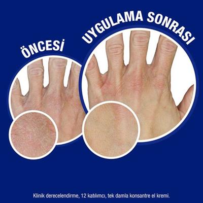 Neutrogena Konsantre El Kremi Parfümlü 75ml