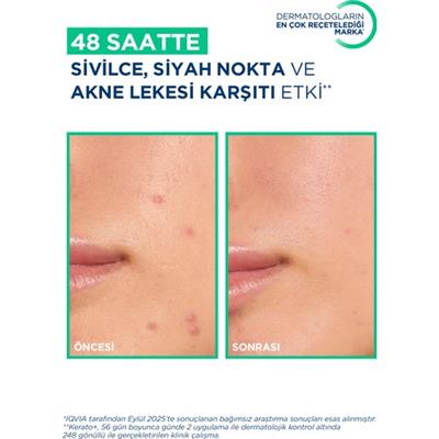 Bioderma Sebium Kerato+ Sivilce, Akne Lekesi Karşıtı AHA, BHA, Salisilik Asit İçeren Bakım Kremi 30 ml