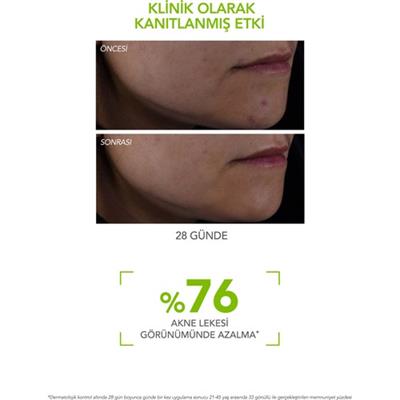Bioderma Yaşlanma ve Akne Karşıtı Hyaluronik Asitli Serum Yağlı Ciltler Günlük Bakım 30 ml