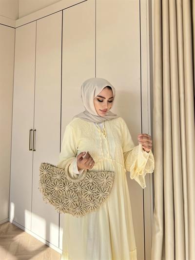 Hadise Kolları Dantel Elbise - Sarı