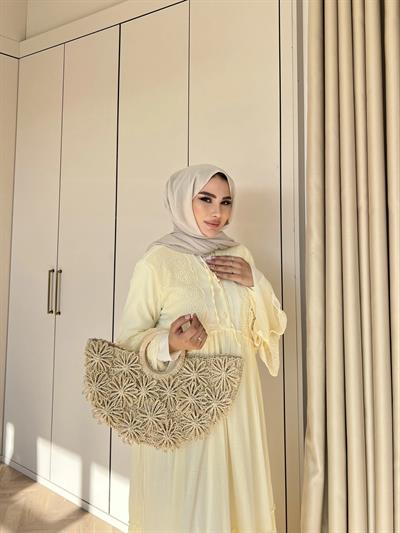 Hadise Kolları Dantel Elbise - Sarı