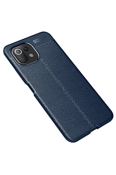 Xiaomi Mİ 11 Lite Kılıf Auto Focus Kapak - Lacivert