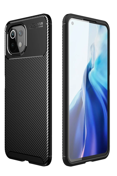 Xiaomi Mİ 11 Lite Kılıf Auto Focus Karbon Kapak - Siyah