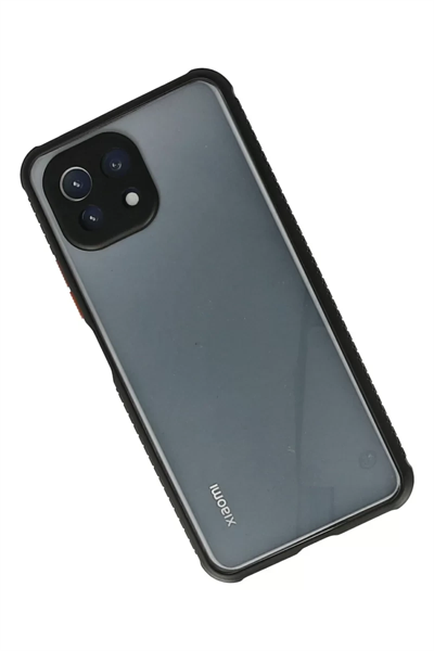 Xiaomi Mİ 11 Lite Kılıf Miami Şeffaf Silikon - Siyah