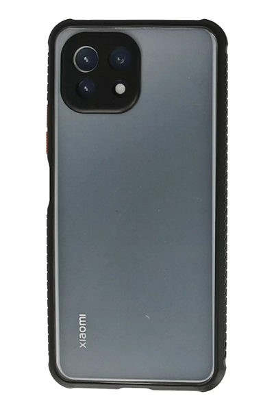 Xiaomi Mİ 11 Lite Kılıf Miami Şeffaf Silikon - Siyah