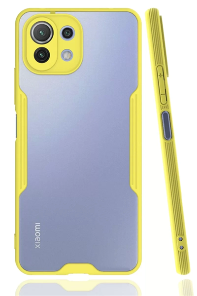 Xiaomi Mİ 11 Lite Kılıf Platin Silikon - Sarı