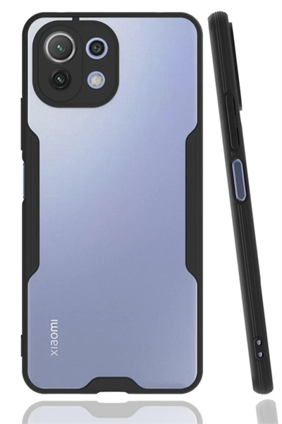 Xiaomi Mİ 11 Lite Kılıf Platin Silikon - Siyah