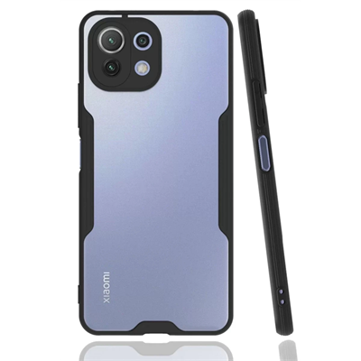 Xiaomi Mİ 11 Lite Kılıf Platin Silikon - Siyah