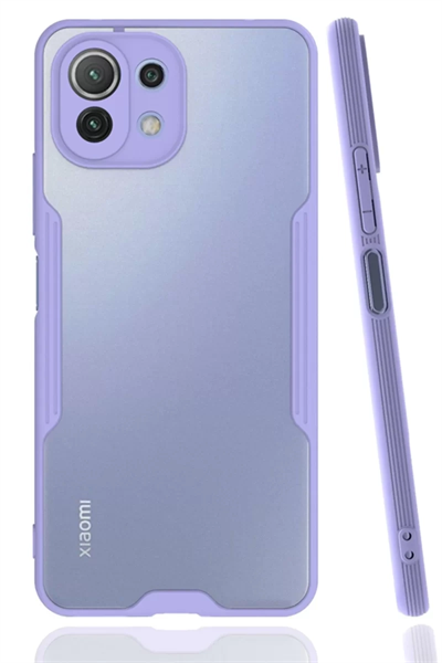 Xiaomi Mİ 11 Lite Kılıf Platin Silikon - Lila