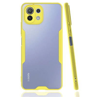 Xiaomi Mİ 11 Lite Kılıf Platin Silikon - Sarı