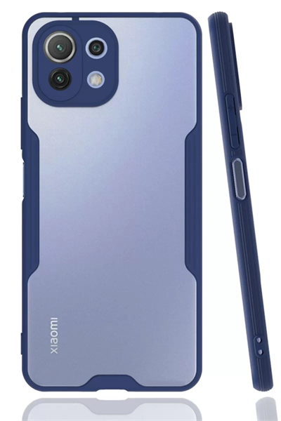 Xiaomi Mİ 11 Lite Kılıf Platin Silikon - Lacivert