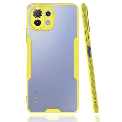 Xiaomi Mİ 11 Lite Kılıf Platin Silikon - Sarı