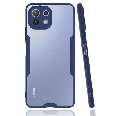 Xiaomi Mİ 11 Lite Kılıf Platin Silikon - Lacivert