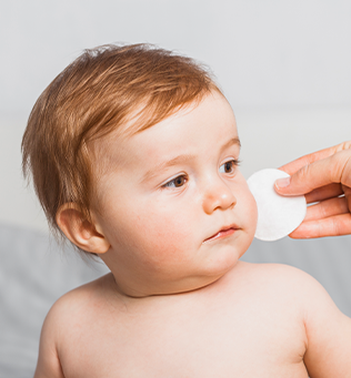 Bebeklerde Alerjik Reaksiyonlara Karşı Ne Yapılmalı?