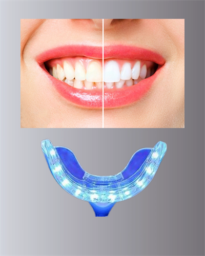 LED Işıklı Profesyonel Diş Beyazlatma Seti