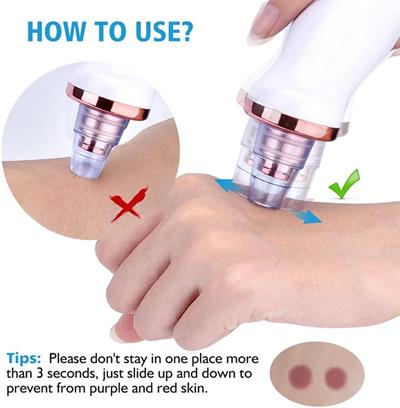 Şarjlı Siyah Nokta Temizleme Cihazı 5 Başlıklı (3936)