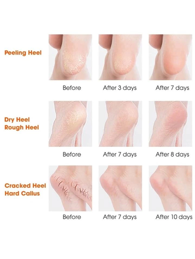 Silikon Topuk Nemlendirici Çorap