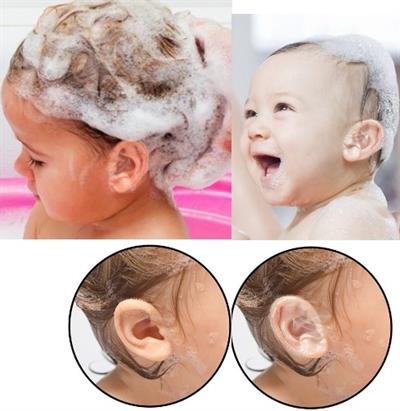 Su Geçirmez Yapışkanlı Kulak Koruyucu Bant 10 lu Paket (3936)